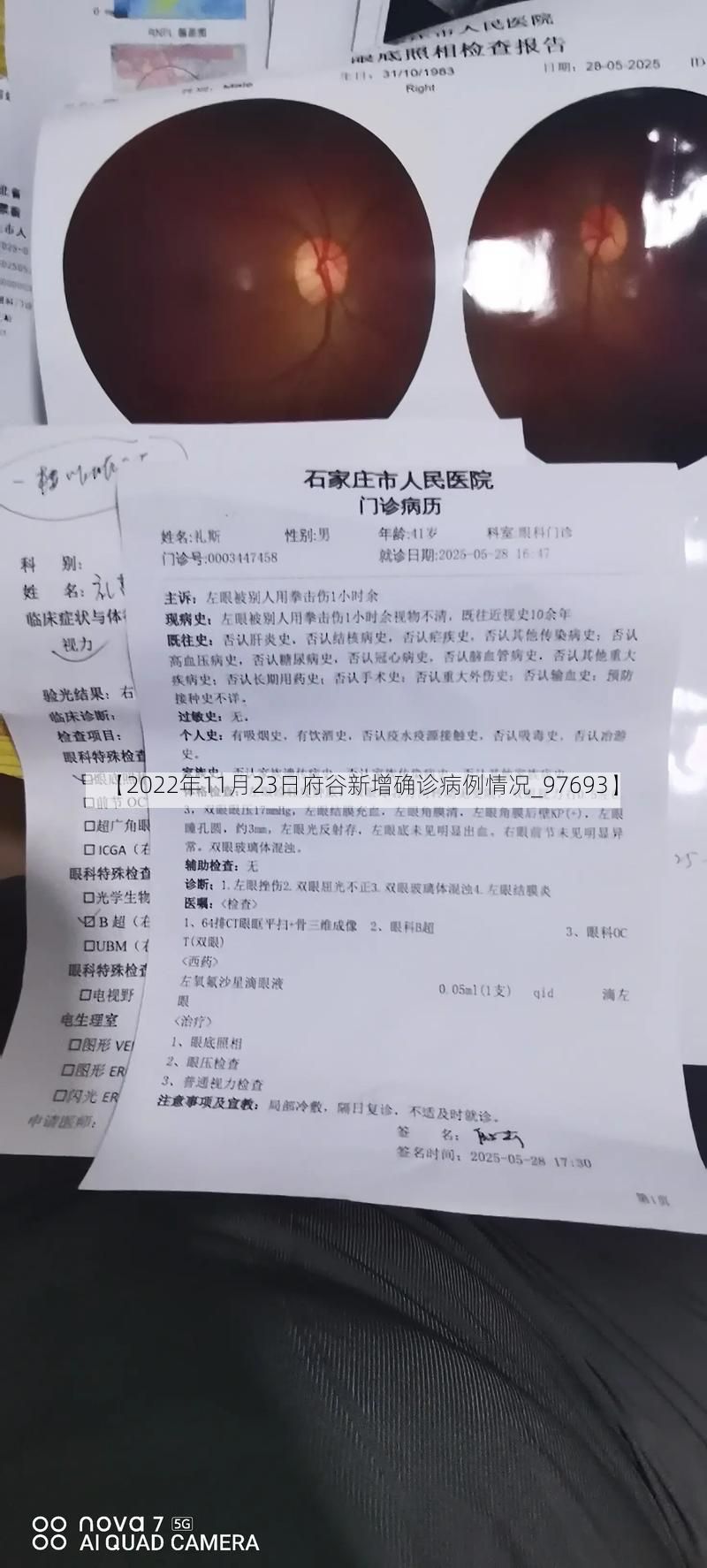 【2022年11月23日府谷新增确诊病例情况_97693】